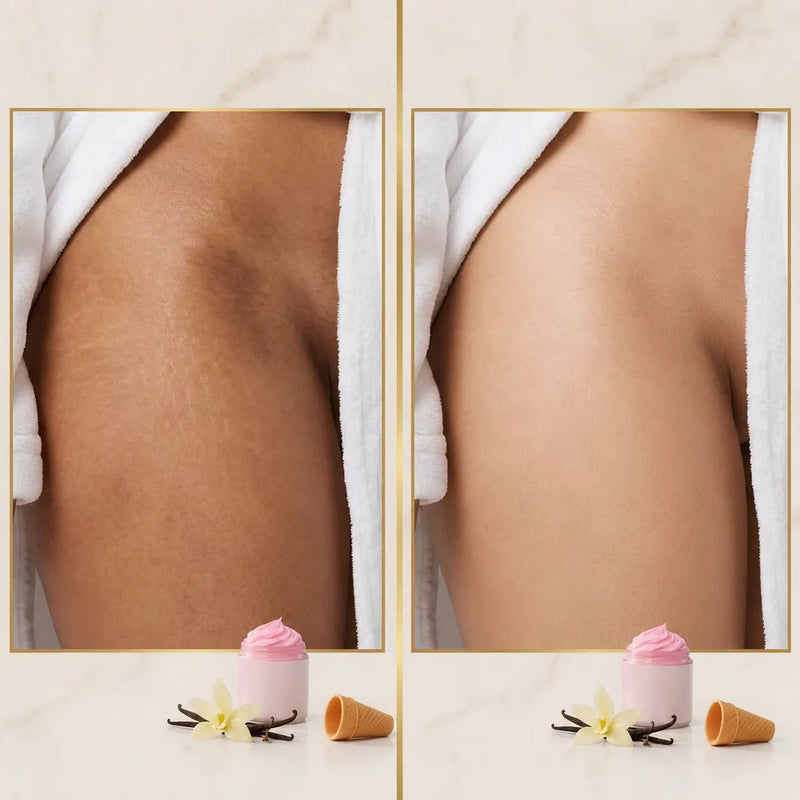 Antes: ingle irritada con granitos y manchas post-depilación / Después: piel suave, pareja y consentida