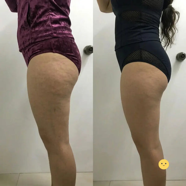 Malla lavable e intercambiable retirada del masajeador lista para enjuagar