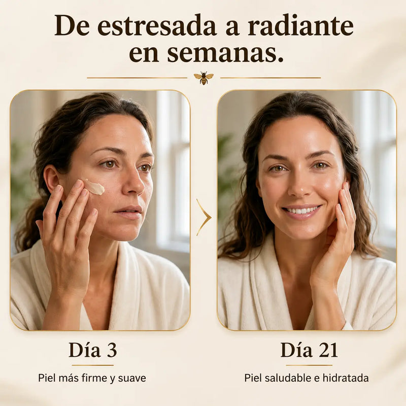 Antes: mejillas resecas y descamadas por el frío / Después: piel suave e hidratada tras dos semanas de uso