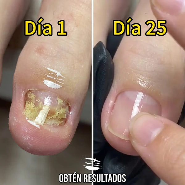 Los dos frascos de 30 ml del 2x1 del tratamiento de uñas 7 Days uno al lado del otro
