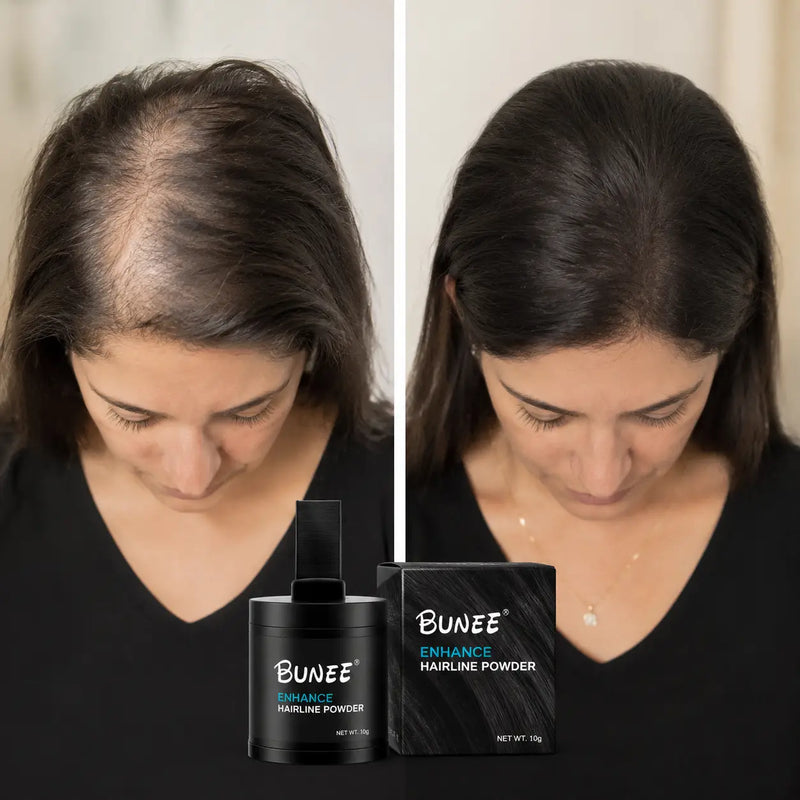Antes: partición clareada con canas a la vista / Después: cuero cabelludo cubierto y natural