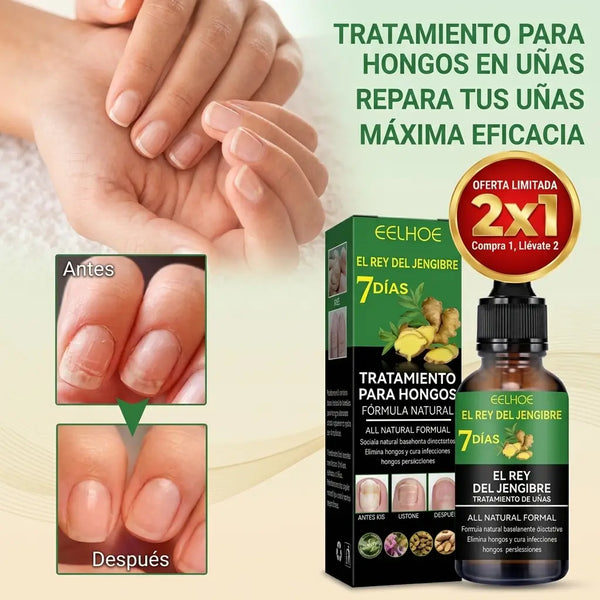 Mano sosteniendo el gotero y aplicando dos gotas del suero de jengibre sobre la uña del pie