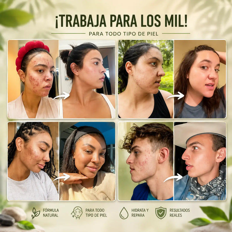 Antes: piel de la mejilla reseca y escamada. Después: piel suave e humectada